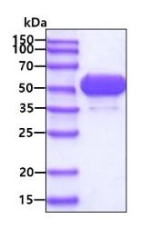 SDS-PAGE (ALDH1A1-01H).jpg